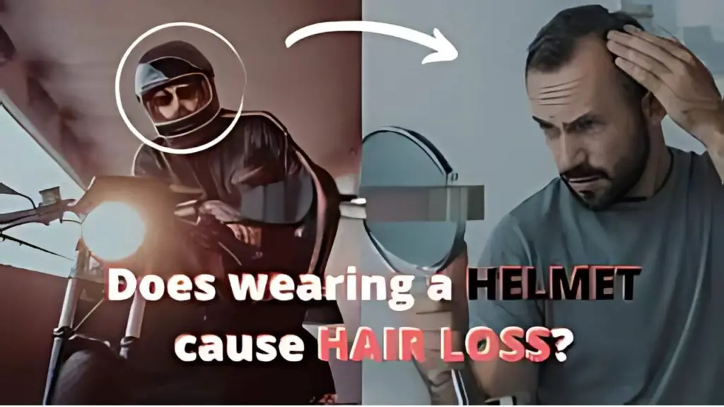 Does wearing a motorcycle helmet cause hair loss?